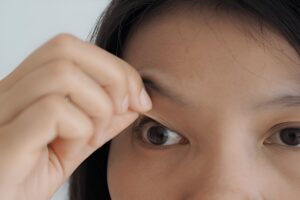 Causes Bulging Eyes Thyroid Eye Disease