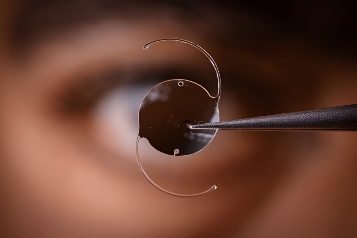 Multifocal Intraocular Lens