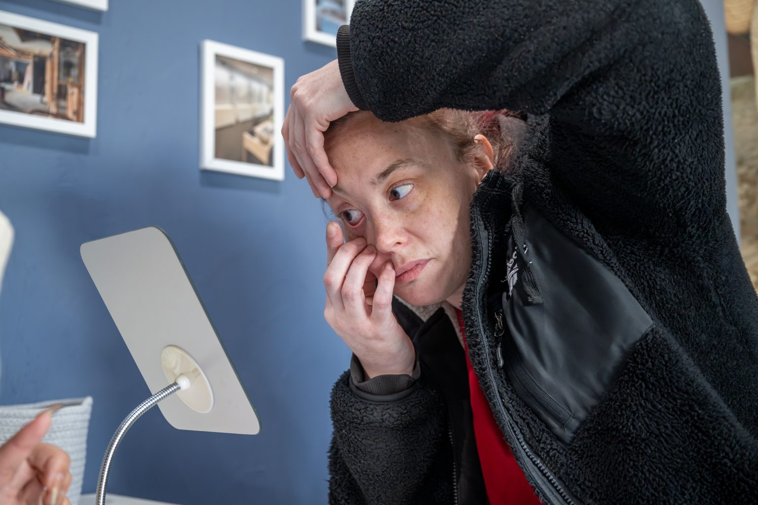 Toric Contact Lenses For Astigmatism Custom Toric Lenses In Worcester